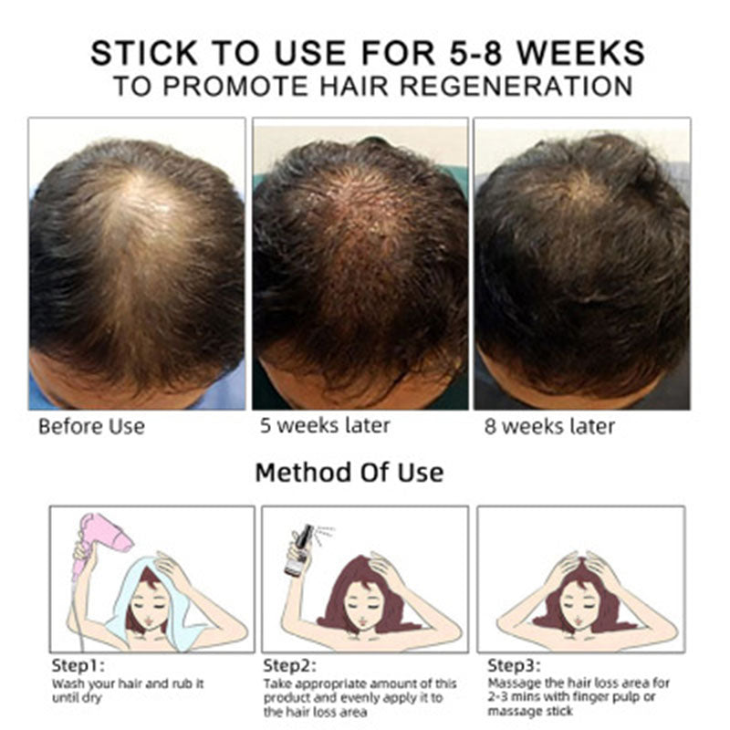 Hair Growth Oil – Natural Essential Oil for Stronger & Healthier Hair