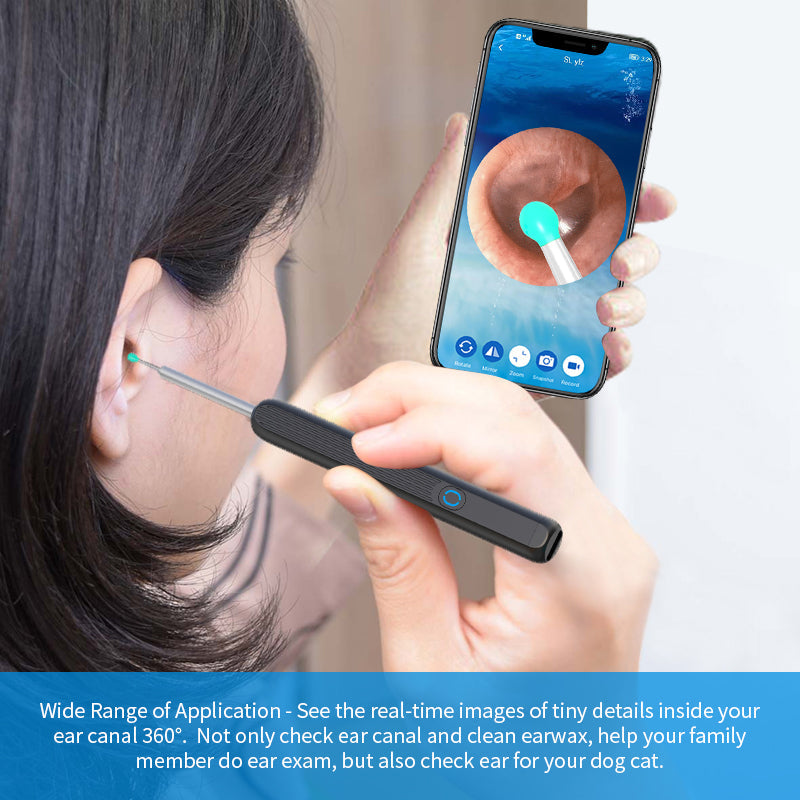 NE3 Ear Cleaner Otoscope – Wireless Ear Wax Removal Tool with Camera & LED Light for iPhone & Android