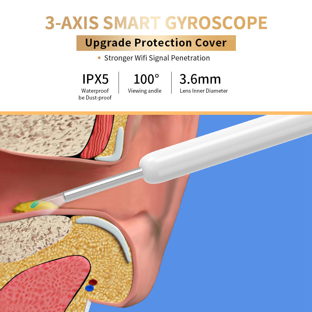NE3 Ear Cleaner Otoscope – Wireless Ear Wax Removal Tool with Camera & LED Light for iPhone & Android