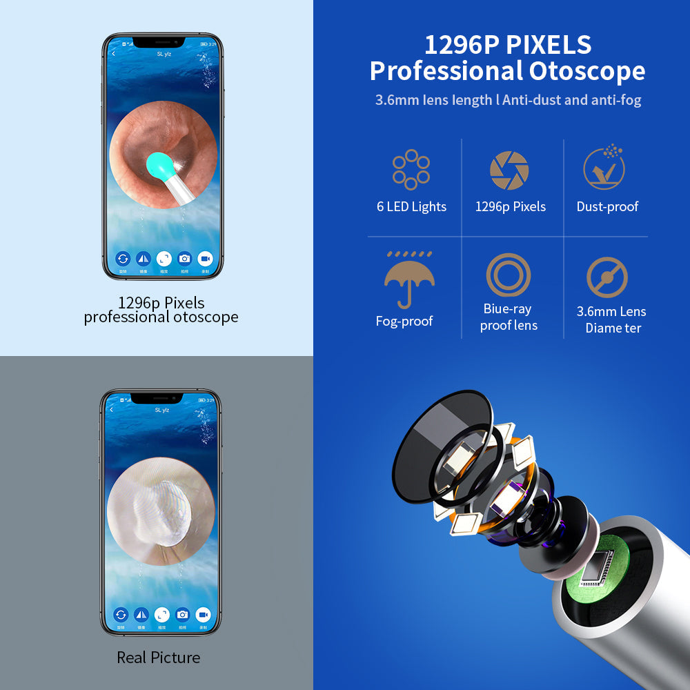 NE3 Ear Cleaner Otoscope – Wireless Ear Wax Removal Tool with Camera & LED Light for iPhone & Android
