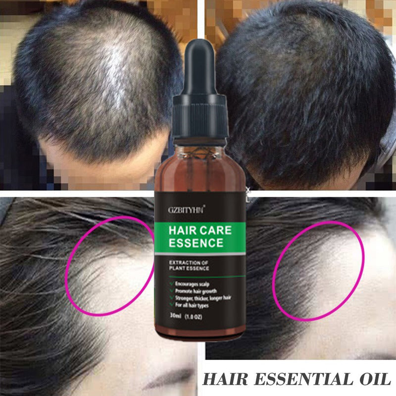 Hair Growth Oil – Natural Essential Oil for Stronger & Healthier Hair