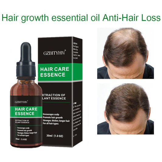 Hair Growth Oil – Natural Essential Oil for Stronger & Healthier Hair