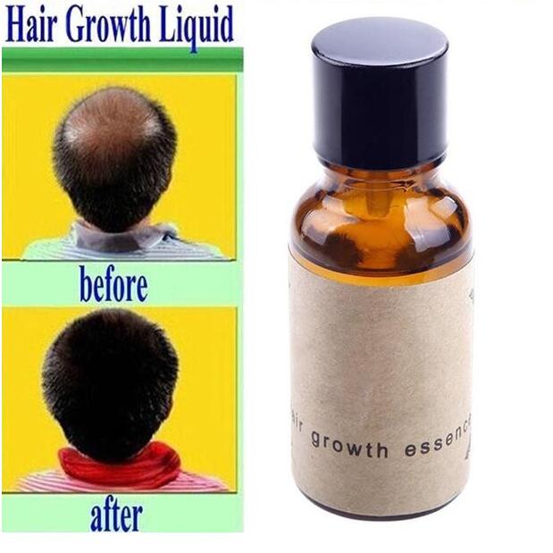 Hair Growth Liquid – Advanced Scalp Treatment for Stronger, Thicker & Healthier Hair