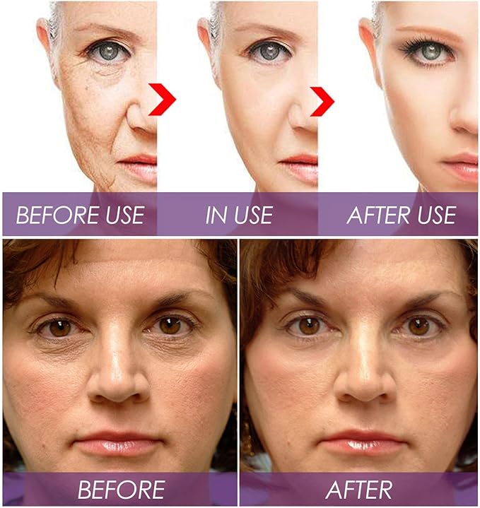 Venature Bakuchiol Retinol Serum – Anti-Aging & Anti-Wrinkle Facial Serum for Glowing Skin (30ml)